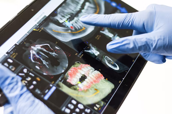 How Dental Implants Improve Your Quality of Life Even Years After the Procedure