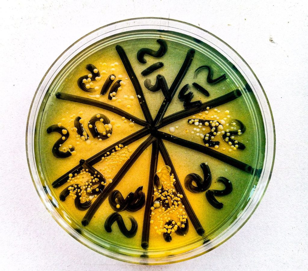 Phage Therapy Trials Offer Hope Against Resistant Infections Laboratory research with petri dishes